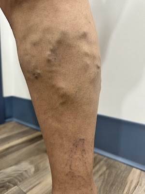 Loop Medical Center: Pain Management and Varicose Vein Doctor in Chicago