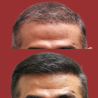 Maxim Hair Restoration & Transplants – Albany