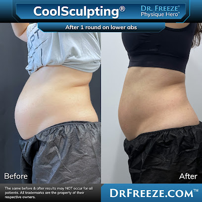 Dr. Freeze – CoolSculpting Expert