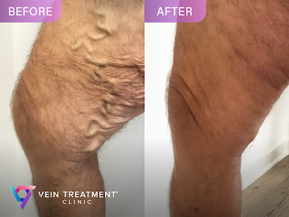 Vein Treatment Clinic Vein Treatment Clinic