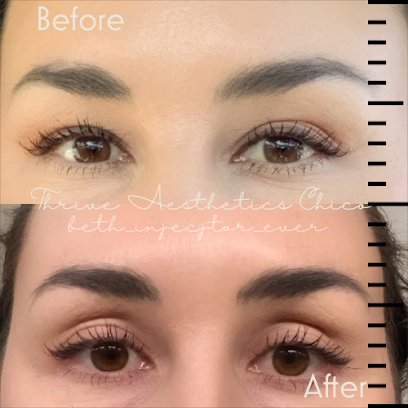Thrive Aesthetics Chico