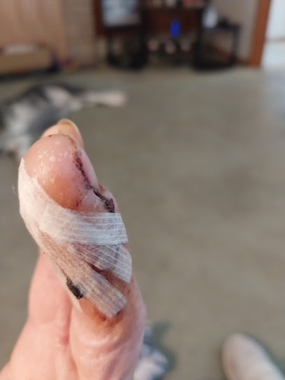 Hand Microsurgery